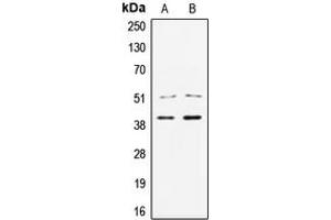 Western blot analysis of TCF7 expression in Jurkat (A), HCT29 (B) whole cell lysates.
