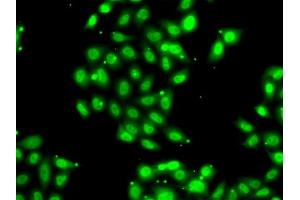 Immunofluorescence analysis of U2OS cells using PI antibody . (PIAS3 抗体  (AA 399-628))