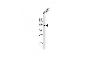 Image no. 2 for anti-Runt-Related Transcription Factor 1 (RUNX1) (AA 300-350) antibody (ABIN3028996)