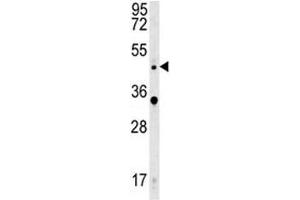 Western Blotting (WB) image for anti-Wingless-Type MMTV Integration Site Family, Member 5A (WNT5A) (AA 185-213) antibody (ABIN3029634)