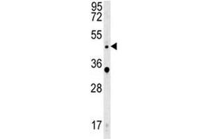 WNT5A antibody western blot analysis in HeLa lysate. (WNT5A 抗体  (AA 185-213))