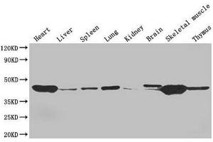 Western Blot Positive WB detected in: Mouse heart tissue, Mouse liver tissue, Mouse spleen tissue, Mouse lung tissue, Mouse kidney tissue, Mouse brain tissue, Mouse skeletal muscle tissue, Mouse thymus tissue All lanes: ACTA1 antibody at 4 μg/mL Secondary Goat polyclonal to rabbit IgG at 1/50000 dilution Predicted band size: 43 kDa Observed band size: 43 kDa (Actin 抗体  (AA 3-377))