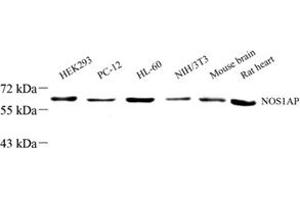 Western blot analysis of NOS1AP (ABIN7074844) at dilution of 1: 1000 (NOS1AP 抗体)