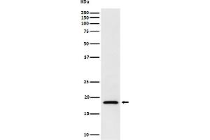 anti-Eukaryotic Translation Initiation Factor 1A, X-Linked (EIF1AX) antibody