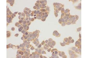 ICC testing of HSP90 antibody and MCF-7 cells (HSP90AA1 抗体  (AA 2-365))