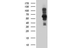 Western Blotting (WB) image for anti-PDZ and LIM Domain 5 (PDLIM5) antibody (ABIN1500131) (PDLIM5 抗体)