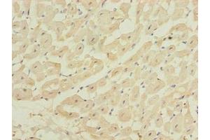 Immunohistochemistry of paraffin-embedded human heart tissue using ABIN7175990 at dilution of 1:100 (ZBTB6 抗体  (AA 115-424))