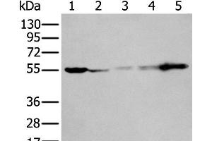 Western blot analysis of 293T A549 A431 Hela and Jurkat cell lysates using PFKFB3 Polyclonal Antibody at dilution of 1:400 (PFKFB3 抗体)