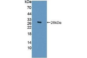 Detection of Recombinant Sp17, Mouse using Polyclonal Antibody to Sperm Protein 17 (Sp17) (SPA17 抗体  (AA 1-149))