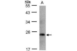 WB Image Sample(30 ug whole cell lysate) A:293T 12% SDS PAGE antibody diluted at 1:1000 (Growth Hormone 1 抗体)