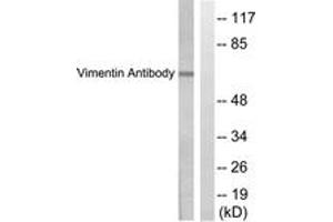 Western blot analysis of extracts from HepG2 cells, treated with Adriamycin 0. (Vimentin 抗体  (AA 411-460))