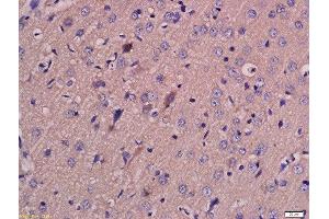 Immunohistochemistry (Paraffin-embedded Sections) (IHC (p)) image for anti-Solute Carrier Family 16 (Monocarboxylic Acid Transporters), Member 3 (SLC16A3) (AA 401-465) antibody (ABIN749303)