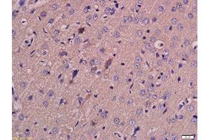 Formalin-fixed and paraffin embedded rat brain labeled with Anti-MCT4 Polyclonal Antibody, Unconjugated  at 1:200 followed by conjugation to the secondary antibody and DAB staining. (SLC16A3 抗体  (AA 401-465))