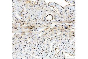IHC analysis of CD31 using anti-CD31 antibody (ABIN5692990).