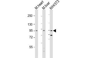 All lanes : Anti-Insr Antibody  at 1:2000 dilution Lane 1: mouse heart lysate Lane 2: mouse liver lysate Lane 3: NIH/3T3 whole cell lysate Lysates/proteins at 20 μg per lane. (Insulin Receptor 抗体  (AA 1325-1358))