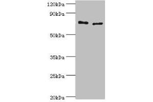 Western blot All lanes: Protein-glutamine gamma-glutamyltransferase 2 antibody at 8 μg/mL Lane 1: Hela whole cell lysate Lane 2: HepG2 whole cell lysate Secondary Goat polyclonal to rabbit IgG at 1/10000 dilution Predicted band size: 78, 62, 39 kDa Observed band size: 78 kDa (Transglutaminase 2 抗体  (AA 438-687))
