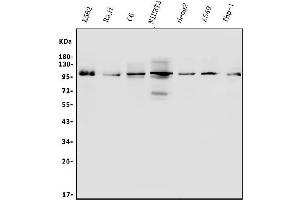 Western blot analysis of ITCH using anti-ITCH antibody (ABIN7600264).