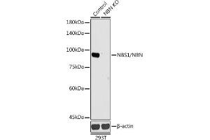 Western blot analysis of extracts from normal (control) and NBS1/NBS1/NBN knockout (KO) 293T cells, using NBS1/NBS1/NBN antibody (ABIN1681204, ABIN3015326, ABIN3015327 and ABIN5663771) at 1:1000 dilution. (Nibrin 抗体  (AA 435-754))