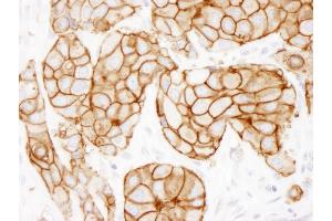 Immunohistochemistry (IHC) image for anti-Receptor tyrosine-protein kinase erbB-2 (ErbB2/Her2) (C-Term) antibody (ABIN7448962)
