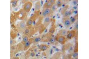 Used in DAB staining on fromalin fixed paraffin-embedded Liver tissue (MBL2 抗体  (AA 129-244))