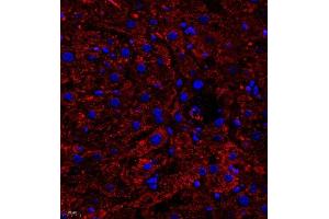 Immunofluorescence of paraffin embedded human liver using B0K (ABIN7073200) at dilution of 1:750 (400x lens) (BOK 抗体)