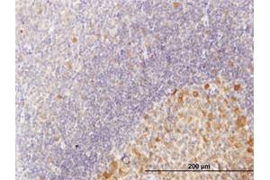 Immunoperoxidase of purified MaxPab antibody to C10orf7 on formalin-fixed paraffin-embedded human tonsil. (CDC123 抗体  (AA 1-336))