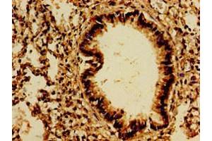 Immunohistochemistry (IHC) image for anti-Protein Tyrosine Phosphatase Receptor Type F (PTPRF) (AA 688-970) antibody (ABIN7167505)