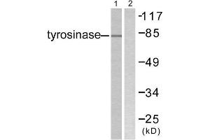 Western Blotting (WB) image for anti-Tyrosinase (TYR) (C-Term) antibody (ABIN1848870) (TYR 抗体  (C-Term))
