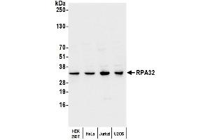 Western Blotting (WB) image for anti-Replication Protein A2, 32kDa (RPA2) (C-Term) antibody (ABIN7454599)