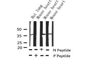 Western blot analysis of Phospho-EFNB1/2 (Tyr330) expression in various lysates (Ephrin B2 抗体  (pTyr330))