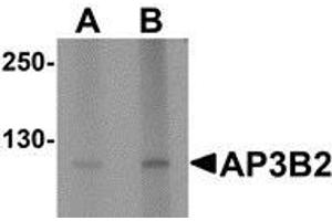 Western blot analysis of AP3B2 in rat brain tissue lysate with AP3B2 antibody at (A) 1 and (B) 2 µg/ml. (AP3B2 抗体  (N-Term))