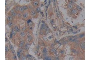 Immunohistochemistry (IHC) image for anti-CD40 (CD40) (AA 26-187) antibody (ABIN7442747)