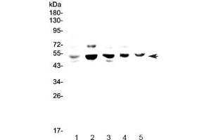 Western blot testing of 1) human HeLa, 2) rat PC-12, 3) mouse lung, 4) mouse ovary and 5) mouse HEPA1-6 lysate with NFIB antibody at 0. (NFIB 抗体)
