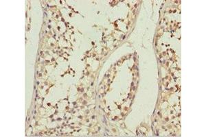 Immunohistochemistry (IHC) image for anti-ATP-Binding Cassette, Sub-Family B (MDR/TAP), Member 8 (ABCB8) (AA 486-735) antibody (ABIN7144897)