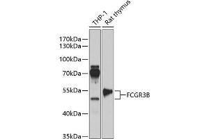 Western blot analysis of extracts of various cell lines, using FCGR3B antibody (ABIN6131279, ABIN6140548, ABIN6140550 and ABIN6218175) at 1:1000 dilution. (FCGR3B 抗体  (AA 1-233))