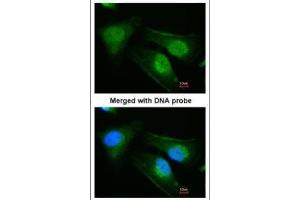 ICC/IF Image Immunofluorescence analysis of paraformaldehyde-fixed HeLa, using DNAJB6, antibody at 1:200 dilution. (DNAJB6 抗体  (Center))