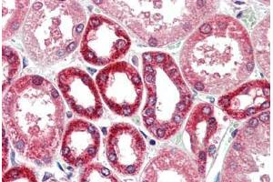 Human Kidney (formalin-fixed, paraffin-embedded) stained with BECN1 antibody ABIN461895 at 5 ug/ml followed by biotinylated goat anti-rabbit IgG secondary antibody ABIN481713, alkaline phosphatase-streptavidin and chromogen. (Beclin 1 抗体  (N-Term))