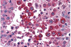 Human Testis (formalin-fixed, paraffin-embedded) stained with STAT4 antibody ABIN239852 at 1:50 followed by biotinylated goat anti-rabbit IgG secondary antibody ABIN481713, alkaline phosphatase-streptavidin and chromogen. (STAT4 抗体  (N-Term))