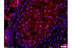 Formalin-fixed and paraffin embedded mouse embryo labeled with Anti-AQP7 Polyclonal Antibody, Unconjugated (ABIN741255) at 1:200, overnight at 4°C, The secondary antibody was Goat Anti-Rabbit IgG, Cy3 conjugated used at 1:200 dilution for 40 minutes at 37°C. (Aquaporin 7 抗体  (AA 251-342))