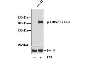 Western blot analysis of extracts from A431 cells using Phospho-GRIN2B(Y1474) Polyclonal Antibody. (GRIN2B 抗体  (pTyr1474))