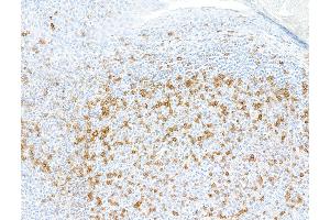 anti-Inducible T-Cell Co-Stimulator (ICOS) (AA 149-199) antibody
