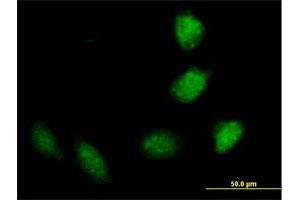 Immunofluorescence of purified MaxPab antibody to TRIM40 on HeLa cell. (TRIM40 抗体  (AA 1-258))