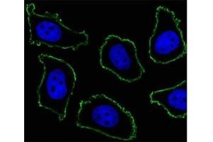 Fluorescent image of A549 cell stained with CD33 antibody at 1:25.