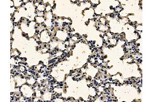 ABIN7097032 and ABIN7101099 at 1/100 staining mouse lung tissue by IHC-P.