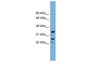 WB Suggested Anti-H1FOO Antibody Titration: 0. (H1FOO 抗体  (Middle Region))