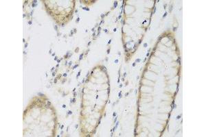 Immunohistochemistry of paraffin-embedded Human stomach using NAT8B Polyclonal Antibody at dilution of 1:200 (40x lens). (NAT8B 抗体)