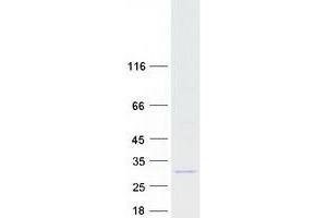Western Blotting (WB) image for ADP-Ribosylation Factor Related Protein 1 (ARFRP1) (Transcript Variant 1) protein (Myc-DYKDDDDK Tag) (ABIN2714864)