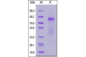 SARS-CoV-2 Nucleocapsid protein, His Tag on  under reducing (R) condition. (SARS-CoV-2 Nucleocapsid Protein (SARS-CoV-2 N) (D3L, G204R, R203K, S235F) (His tag))