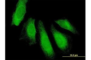 Immunofluorescence of purified MaxPab antibody to UBAP1 on HeLa cell. (UBAP1 抗体  (AA 1-502))