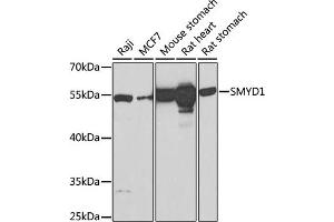 Western blot analysis of extracts of various cell lines, using SMYD1 Antibody (ABIN6128707, ABIN6148163, ABIN6148165 and ABIN6219496) at 1:1000 dilution. (SMYD1 抗体  (AA 1-350))